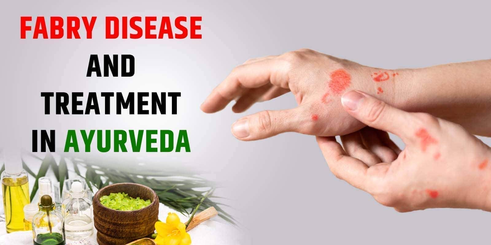 Fabry Disease and Treatment in Ayurveda